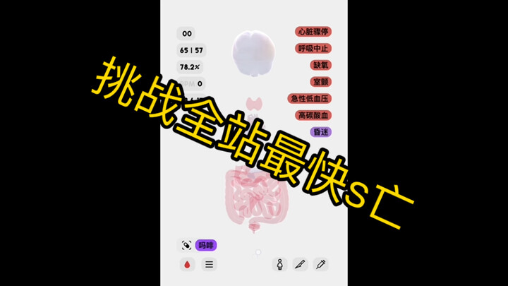 【生命life】挑战全站最快s亡 一针腺苷直接“风平浪静”