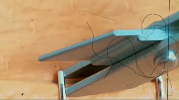 Why Do Doctors Use STAPLES Instead of Stitches?!