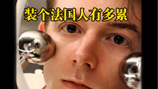 Tôi nghĩ mình cần bắt đầu tiêm botox :-|