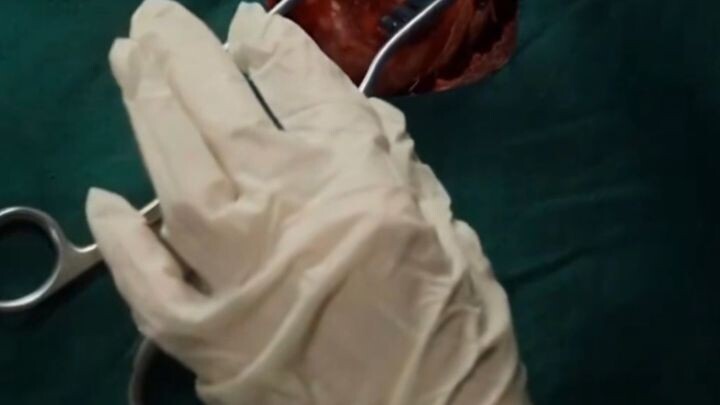 ปริศนาผ่าตัดมรณะ ซับไทย