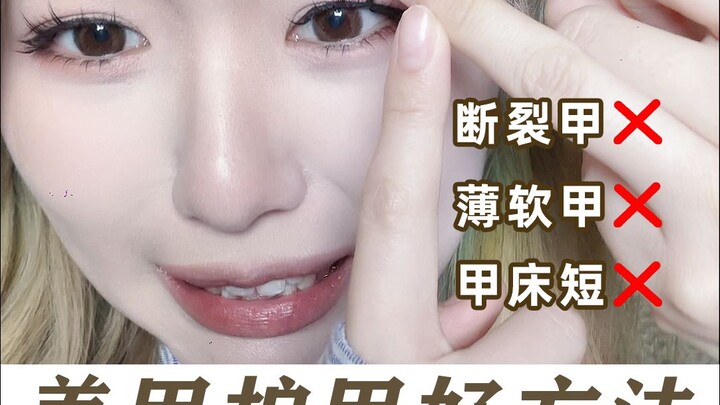 บทเรียนแสนเจ็บปวด! สาวๆ ที่ชอบทำเล็บต้องดูให้หมด! อย่าลืมดูแลเล็บให้ดีนะ!