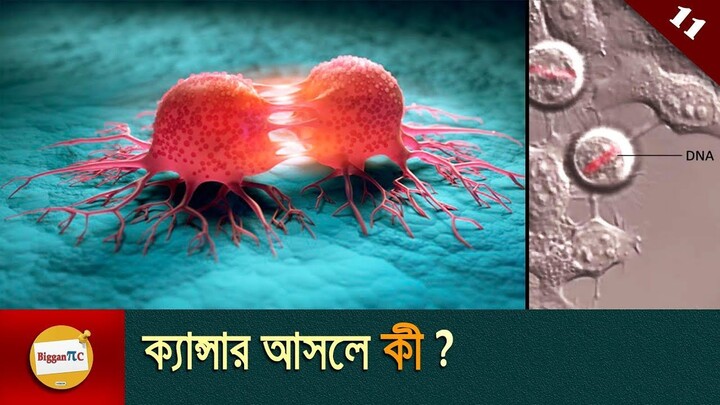 ক্যান্সার কি এবং ক্যান্সারের কারণ What is cancer and Causes cancer in bangla