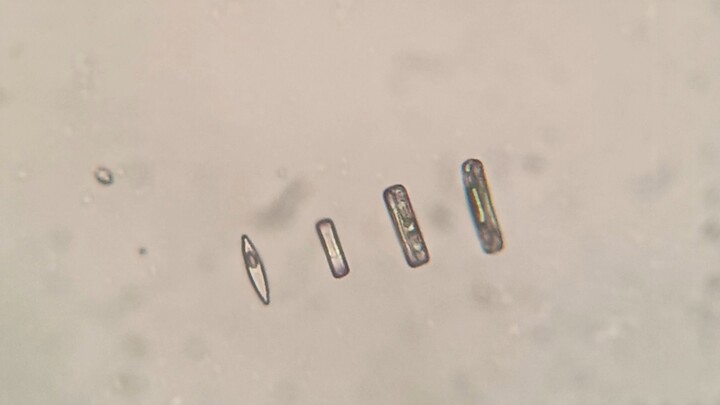 نجح في ترتيب الدياتومات باستخدام جهاز مناورة مجهرية محلي الصنع
