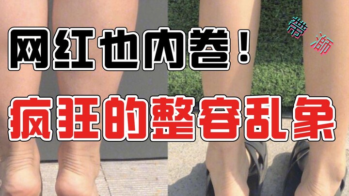 【瓜皮】网红也内卷！赌上性命的网红们：小腿神经阻断术，颅顶注泥，填充精灵耳