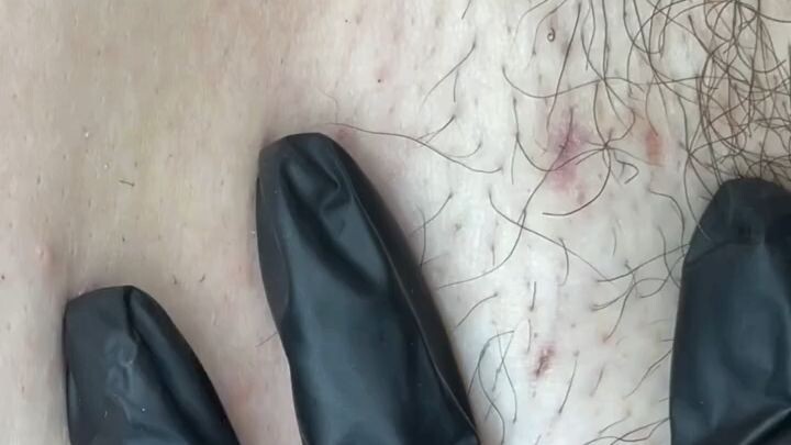 💕 Cada procedimento tem seu processo, e acompanhar cada etapa é uma das partes mais satisfatórias!
