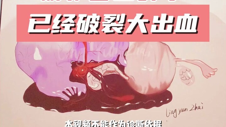 Tại sao đau bụng mà quy trình khám ở bệnh viện lại phức tạp đến vậy? Đằng sau mỗi quy tắc đều là nhữ