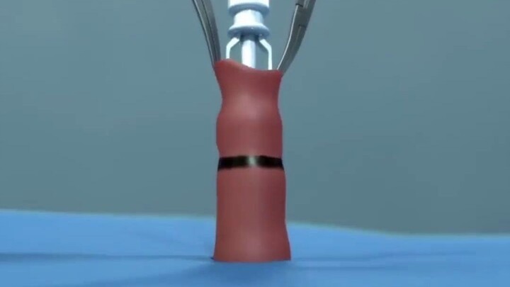 【อนิเมชันให้ความรู้】‘ดาบยาว’ ของผู้ชายถอดเสื้อคลุมออกได้อย่างไร?