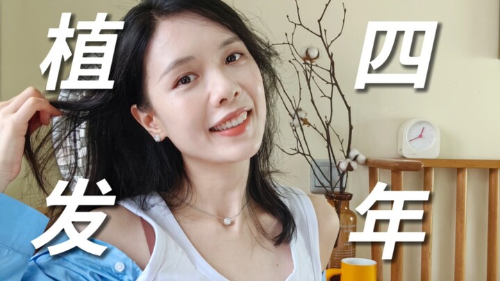 Bốn năm trước tôi đã đi cấy tóc, bây giờ tình trạng thế nào rồi?