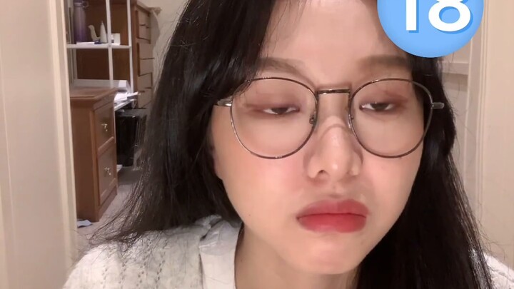 Latihan otot angkat labial dan alar! Meningkatkan depresi dasar hidung! Tidak ada lipatan nasolabial