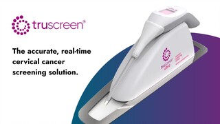 Introducing TruScreen - the accurate, AI-enabled, real-time cervical cancer screening device