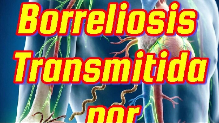 Progresión de la borreliosis transmitida por garrapatas