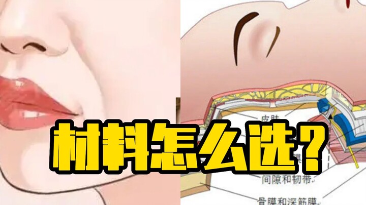 How Do You Pick the Right Materials?