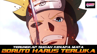 TERUNGKAP SUDAH KENAPA MATA BORUTO HARUS TERLUKA