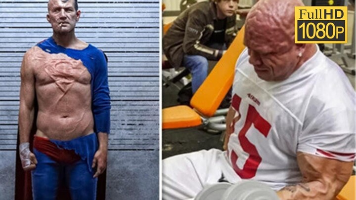 Four People Who Failed to Become Superheroes! They Underwent Radical Cosmetic Surgery Just to Transf