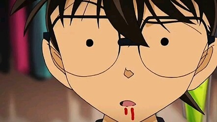 "Detective Conan" Conan: Impossible, how could anyone like Sonoko?