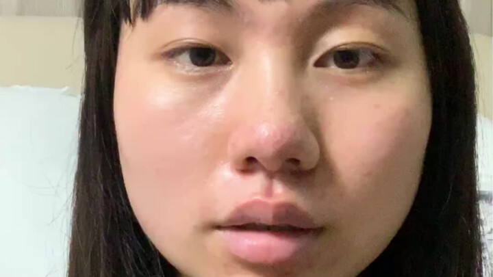 Skin improvement is a slow process: Be willing to invest big and stick with it.