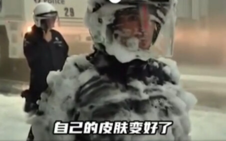 I didn't expect my skin to get better hahahaha