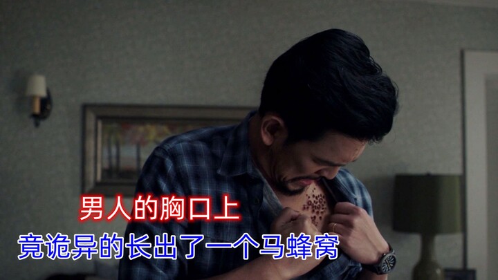 ที่หน้าอกของผู้ชายกลับขึ้นเป็นรังต่อ ซึ่งสาเหตุก็เพราะไปทำให้เด็กหญิงคนหนึ่งไม่พอใจนั่นเอง