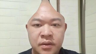 ทำไมหัวของอาร์โนลด์ถึงแหลมจัง?