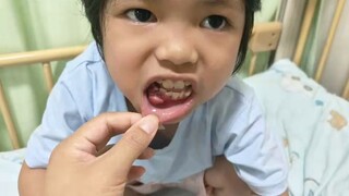 Xinxin, China's first girl with the world's rare disease Papa syndrome, come on Xinxin!