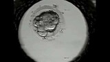 Time lapse microscopy at Elixir Fertility