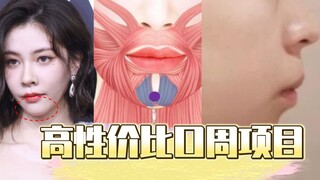 高性价比口周项目