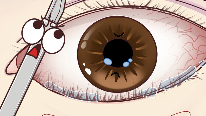 It really sucks when your eyelashes grow into your eyes!