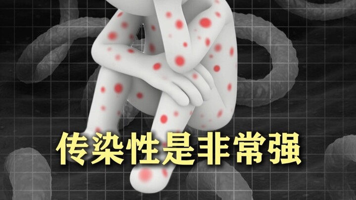 ผู้ป่วยซิฟิลิสวัย 17 ปีที่ทำให้ฉันประทับใจ