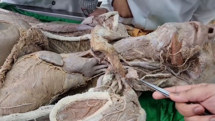 Human Anatomy: Cranial Nerves Dissection & Neck Anatomy Practical.