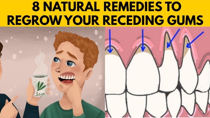 👅8 EASY Ways to GROW BACK Your Receding Gums Naturally AT HOME