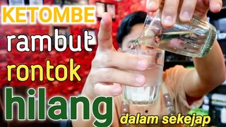 rambut ketombe dan rontok - HILANG DALAM SEKEJAP