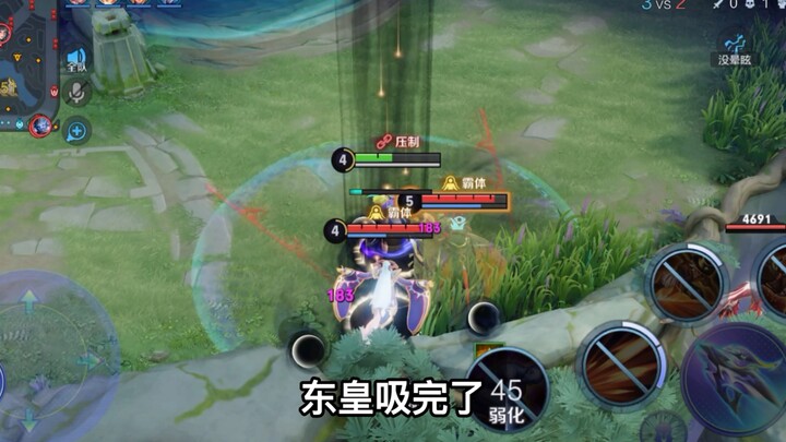 Playing a marksman against these two—how am I supposed to lane?
