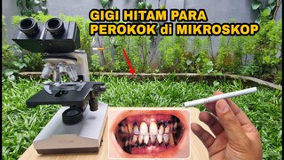 ZOOM 1000X: SARANG BAKTERI/KUMAN PADA GIGI HITAM ASAP ROKOK