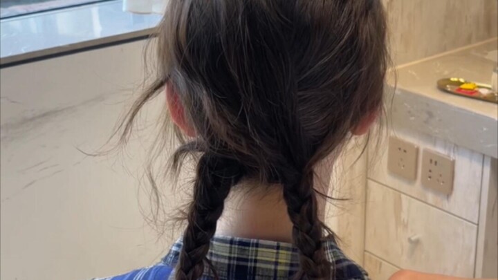 “ศัลยกรรมทำให้ไรผมของสาววัยกลางคนหายไป”