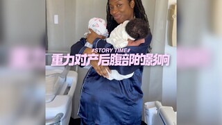 重力对产后腹部的影响