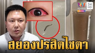 เปิดสาเหตุปรสิตโผล่น้ำคอนโดหรู ไชตาลูกบ้านนับ 100 หวิดบอด | ข่าวเย็นอมรินทร์ | 10 ก.ค. 67