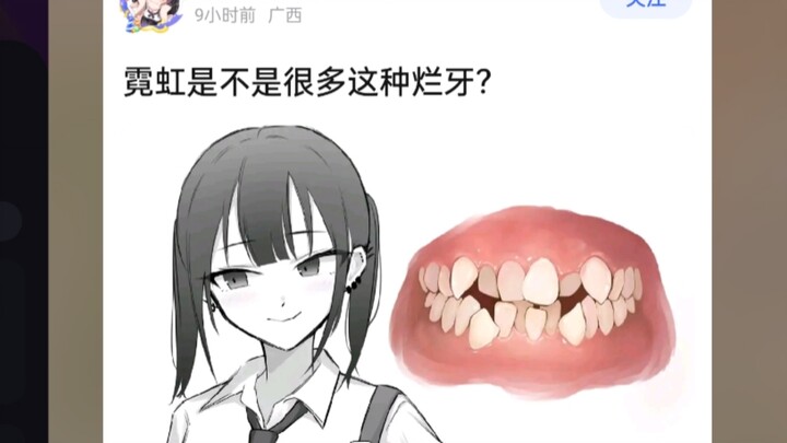นีออนมีฟันแย่ๆ แบบนี้เยอะเลยเหรอ?