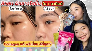 รีวิว Vida Collagen Pure & Gold สิวยุบ ผิวขาวใสใน1อาทิตย์ ลดข้อดัง กระดูกมีเสียง จริง?! |ikziice