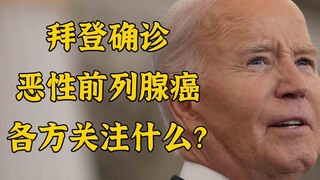 Biden diagnosed with malignant prostate cancer with bone metastasis. What are the concerns of all pa