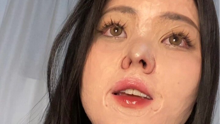 22 Years After Burns: This Is What My Scarred Skin Looks Like After Makeup