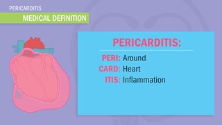 Pericarditis