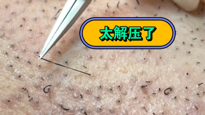 Latest de-stressing video: plucking facial hair is so relaxing!