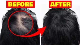 Buhok: 7 Natural Na Paraan Para KUMAPAL ANG BUHOK NG MABILIS