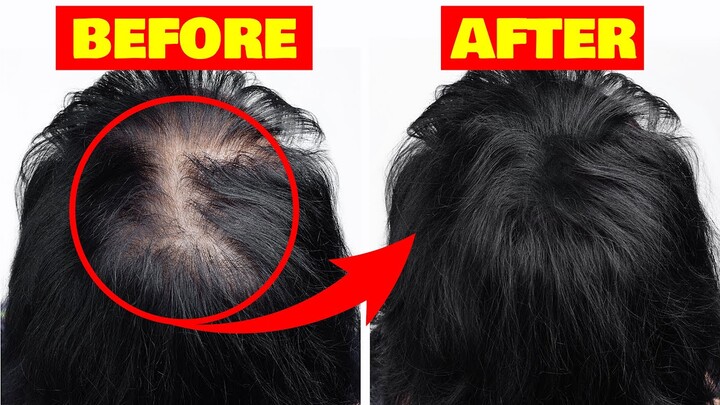 Buhok: 7 Natural Na Paraan Para KUMAPAL ANG BUHOK NG MABILIS