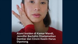 Alami Insiden di Kamar Mandi, Jennifer Bachdim Diselamatkan Damkar dan Cincin Kawin Harus Dipotong