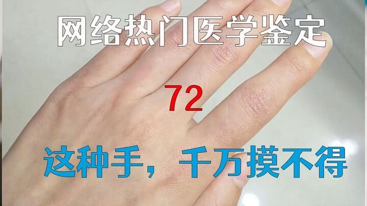 [Online Viral Authentication] This kind of hand—absolutely do not touch it