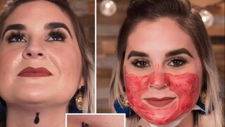 He sucked a lot of my blood with leeches! What kind of weird therapy is this?