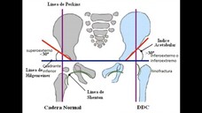 mediciones de la cadera