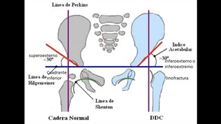 mediciones de la cadera