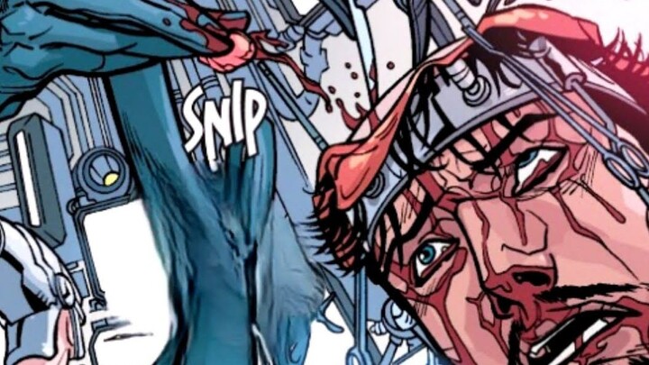 [Shocked] Iron Man’s skull has been opened! The reason? He was hiding an Infinity Stone!